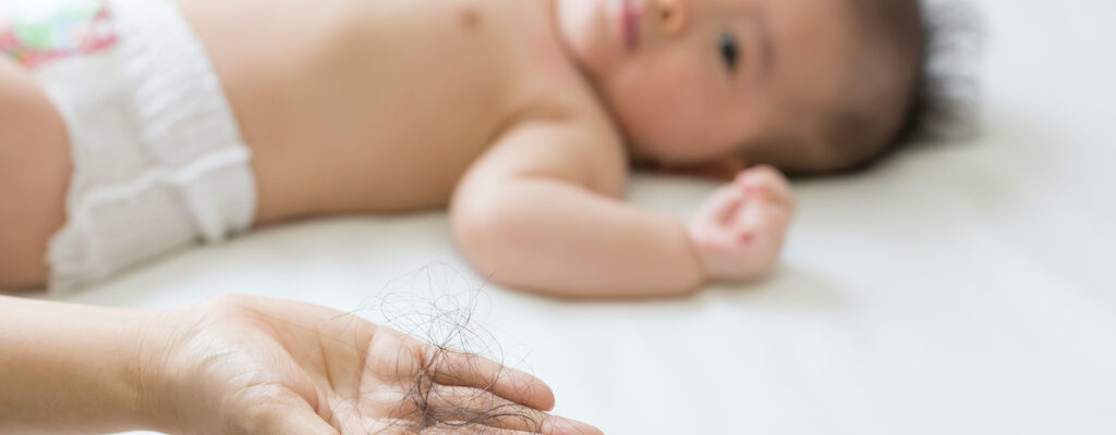 Postpartum Hair Loss: The Hows and Whys