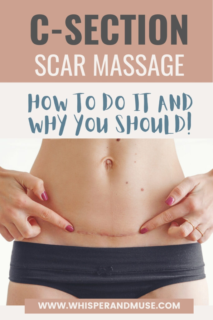 c-section scar massage