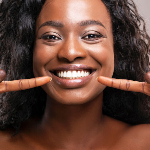 How To Naturally Whiten Your Teeth